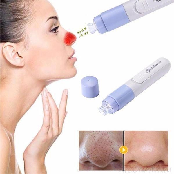 Вакуумный очиститель SPOTCLEANER Face Pore Cleaner вакуумный очиститель пор лица ws66598 фото